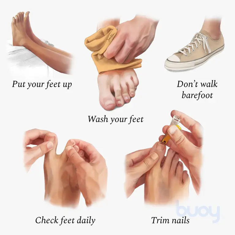 diabetes foot care guide
